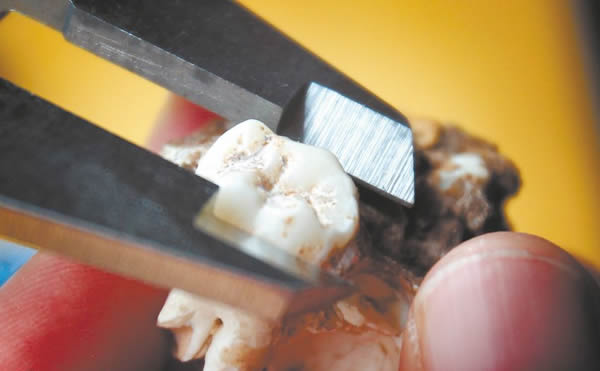 测量古人类牙齿化石