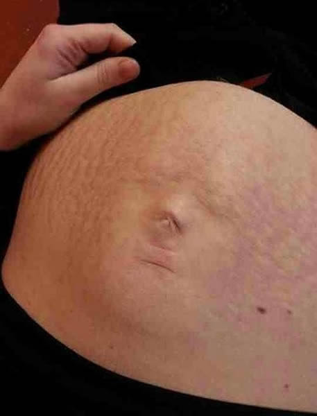 Ӣ��һ���������Ƥ�Ͼ���Ӥ����