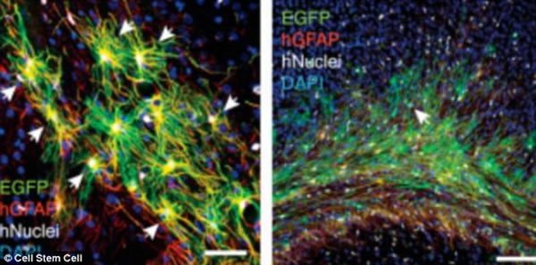 科学家使用显微镜监控植入老鼠大搞的人类胶质细胞,图中绿色部分是人类胶质细胞