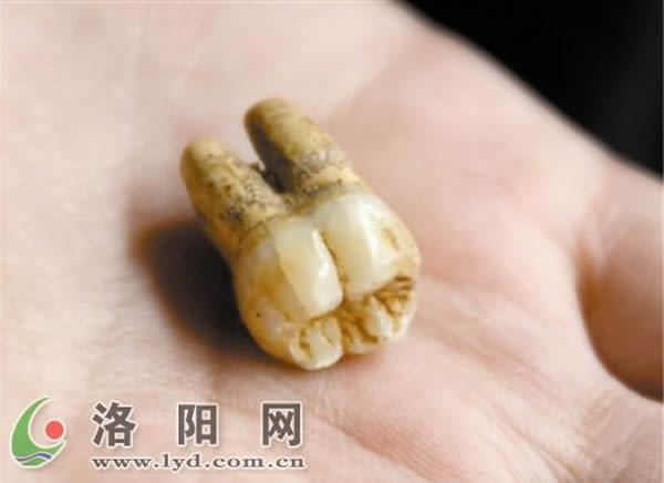 人类牙齿化石