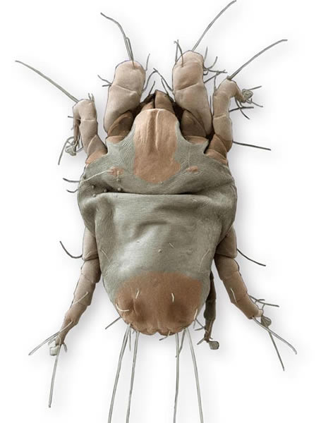 屋尘螨:电子显微镜下的扫瞄图像