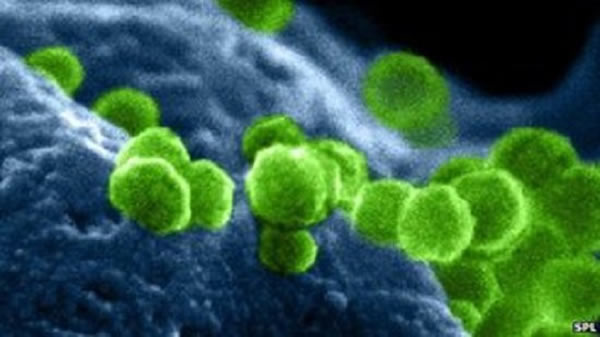 艾滋病病毒冲出了它所劫持的白血球