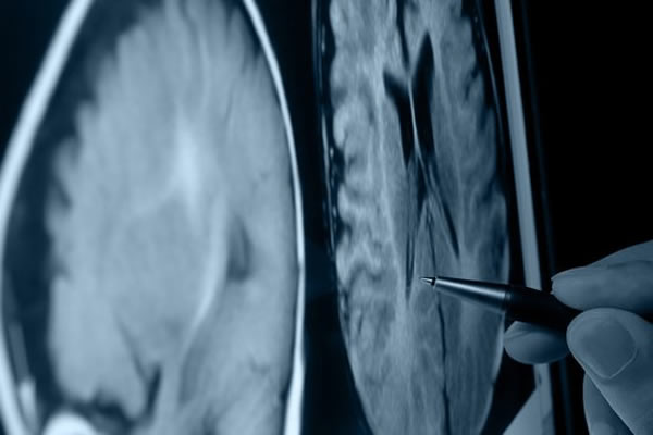 ŴѧѾɹͨϸתΪһ򼲲ٵĴϸ