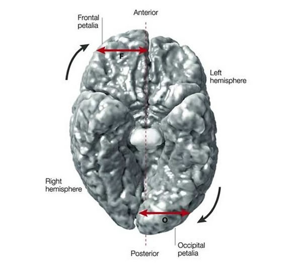 ���ԷǶԳ��Ե���ά��ͼ