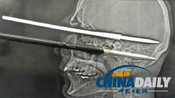 XƬʾ洩۾һ̵ֱ˺ͷǡ