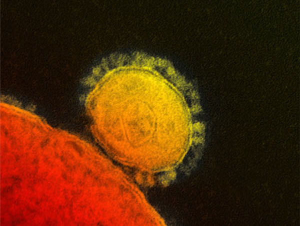中东呼吸系统综合征冠状病毒(MERS-CoV virus)