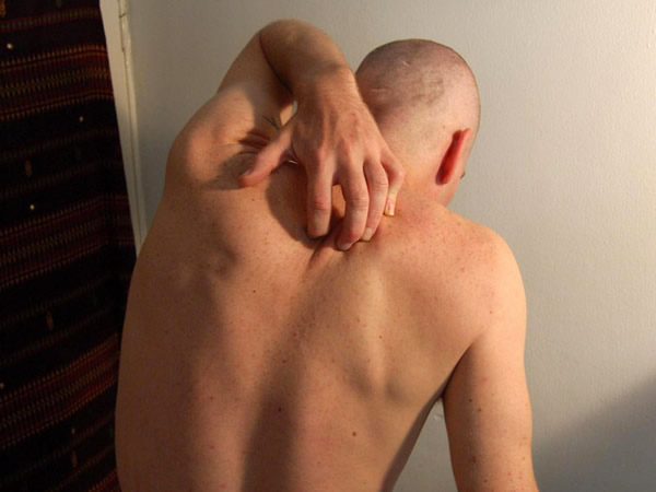 我们皮肤痕痒的原因