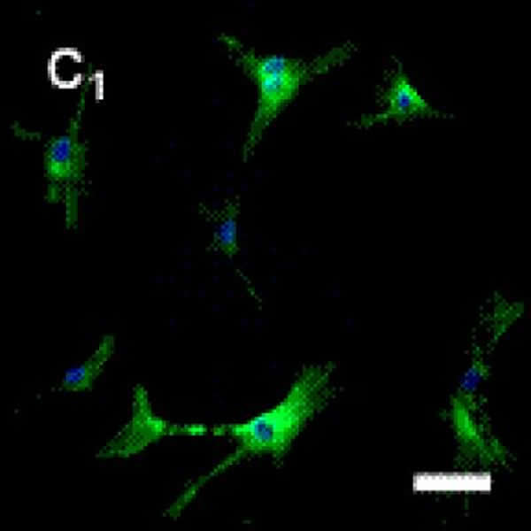 荧光显微镜观察到绵羊羊膜上皮细胞诱导分化28d时,培养基中出现表达神经元特异性标志蛋白β-III-微管蛋白的细胞