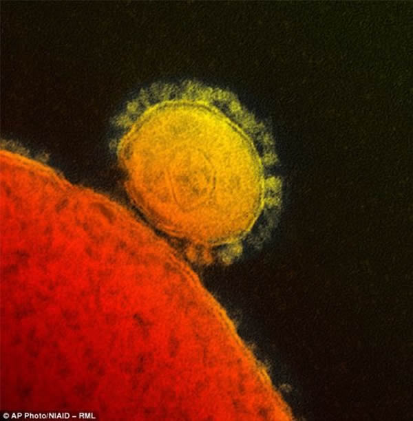 中东出现新的致命病毒“中东呼吸综合征”(MERS)