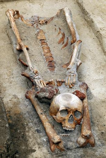 �������������͡���Ѫ������Ĺ