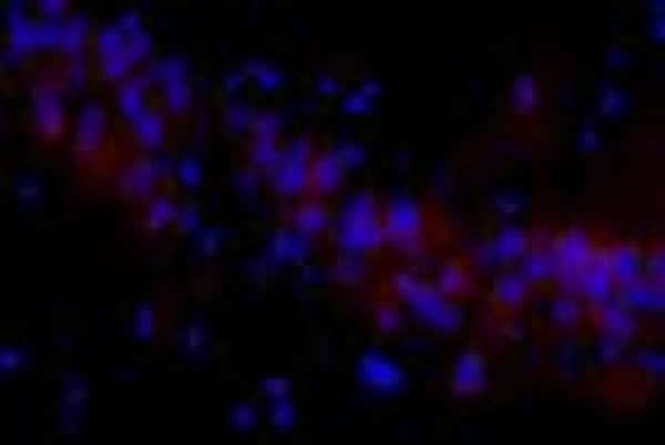 孕期乙醇暴露大鼠的子鼠海马组织中细胞周期性蛋白激酶5荧光染色的神经元数量较多(免疫荧光,×400)