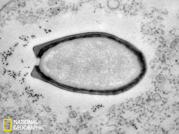 Pandoravirus�����ĵ�����΢��ͼ��