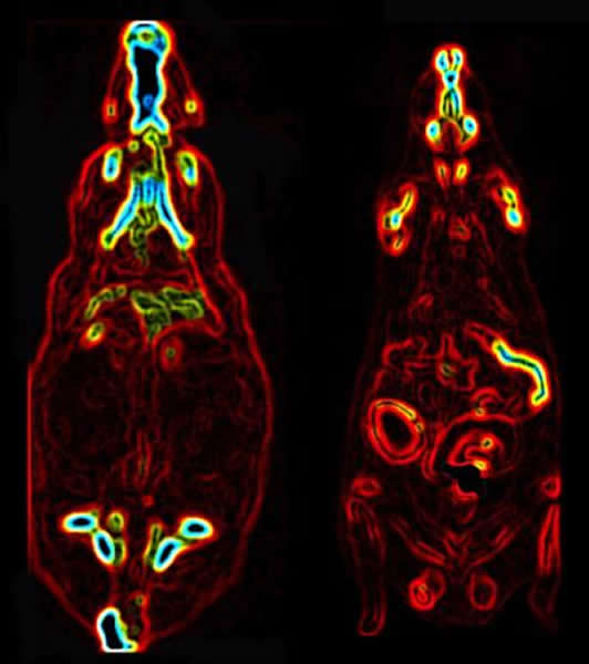 θ·ǰ󣩺ңPET/ CTɨ