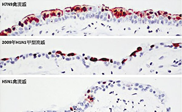 ͼƬ��ʾ����֧������Ƥ��֯����ɫ������ʾ��������Ⱦ��ϸ������ɫ������ʾ�Ǹ�Ⱦ��ϸ�����о�ָH7N9������2009��ļ������У�H1N1���������ơ�