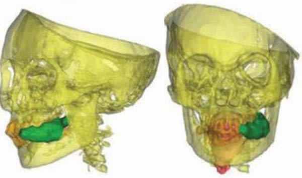 Ůͷǣɫݣɫͷɫ͹ſҶɫ3DӻŮﻹв˼ƬſҶ