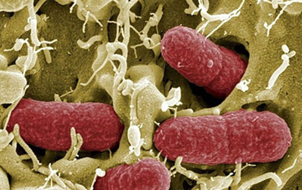 人民币是亚洲最脏货币,平均含菌量17.8万个