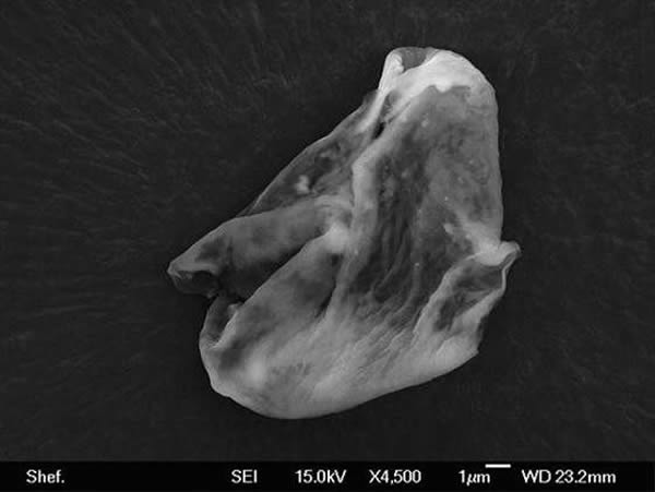 ����һ�ŵ羵ͼ����ʾ�˴��о��з��ֵĹ���ϸ���ڣ�һ���ֿ�ѧ����Ϊ�����Դ��̫�գ���˴���������������ʽ������������ѧ�ҶԴ˹۵����������