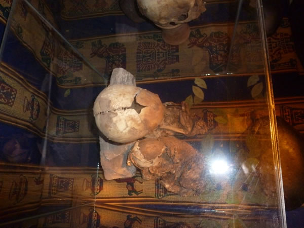 秘鲁出现神秘大头小身骨骸,人类学家表示可能是外星人