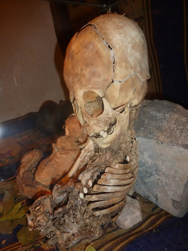 秘鲁出现神秘大头小身骨骸,人类学家表示可能是外星人