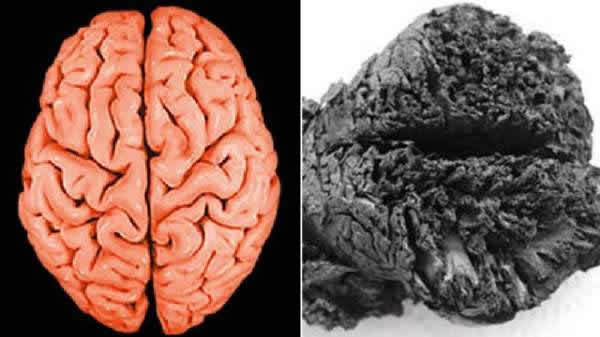 ��õ����Ժ��ѱ���4000������ԶԱ�ͼ