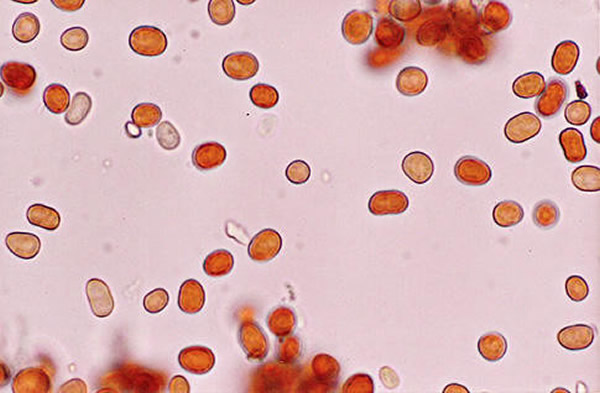 红雨里竟含有细胞状结构