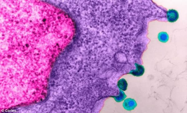 俄罗斯科学家认为他们已经识别出一种更致命的新型HIV变种。这种名为02_AG/A的亚型正在迅速扩散。该图显示的是成熟的HIV病毒感染