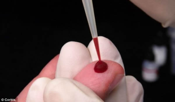 2006年科学家首次在新西伯利亚市看到这种病毒,它被认为是俄罗斯最致命的HIV亚型。据悉,目前在西伯利亚有超过50%的新HIV感染是由它引起的