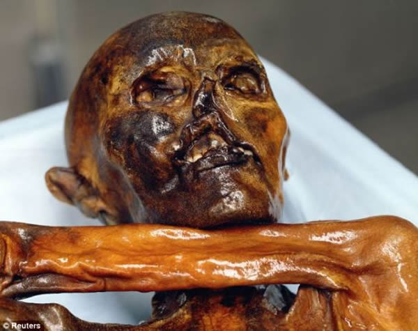 �ڰµ����ĵ��޶�����ѧ�ҷ����˱��ˡ��´ġ���19������������ڶ�3700��������Ѫ�ߵ�DNA���м��֮�󣬿�ѧ���ҵ��ˡ��´ġ�����Щ���