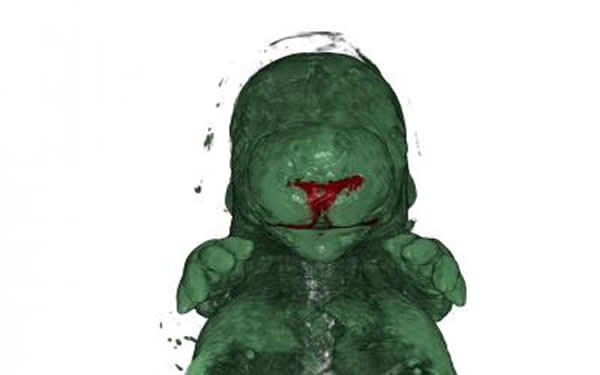 小鼠的面部发展时的基因调控序列的活跃模式启动