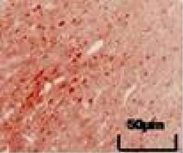 免疫组织化学染色显示,补阳还五汤灌胃14 d,脑缺血大鼠大脑皮质神经干细胞(红色,巢蛋白阳性表达)的数量较多