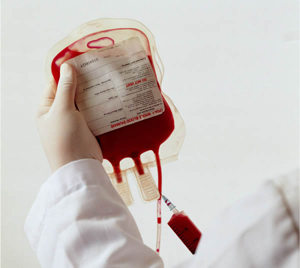 作为一种遗传性血液病,地中海贫血在全球分布广泛