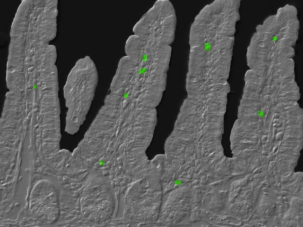 �������ӱ�����ʱ�������ڵ�TH17ϸ��������������