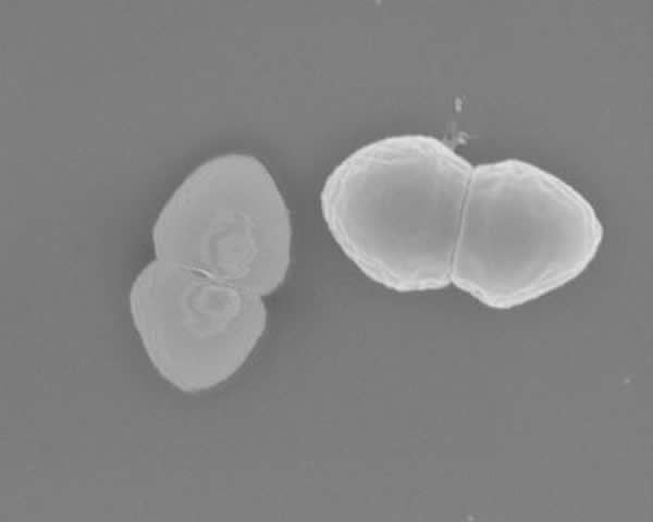 肠球菌hirae的扫描电镜图像