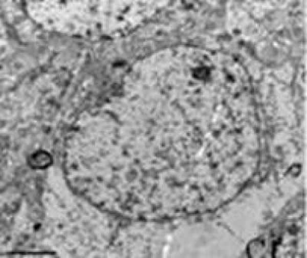 注射dl-3n丁基苯酞后,弥漫性脑损伤大鼠的大脑皮质神经细胞损伤明显减轻,核仁清晰,核膜平滑、连续性较好,线粒体形态基本规则,大多数嵴完整,排列紧密规律,基质颗