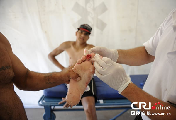 “食人鱼”鲳鱼袭击阿根廷一条河里乘凉的人