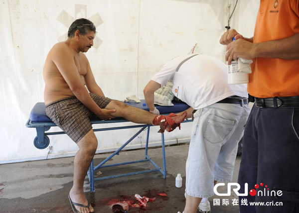 “食人鱼”鲳鱼袭击阿根廷一条河里乘凉的人