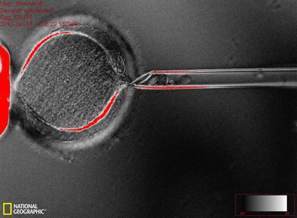 成功克隆人体胚胎并提取干细胞