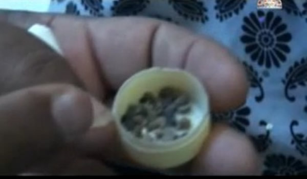 叶门12岁少女流泪时会哭出石头