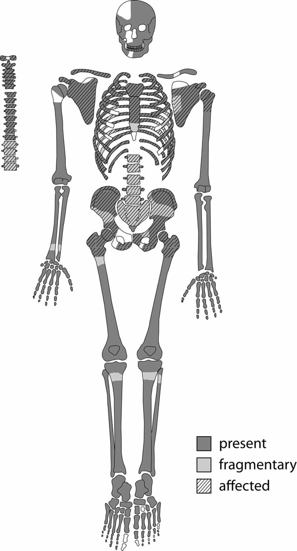 �յ�����һ�߾��3200��İ�֢���ߵĹ���