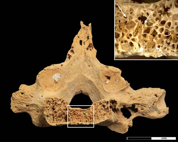 �յ�����һ�߾��3200��İ�֢���ߵĹ���