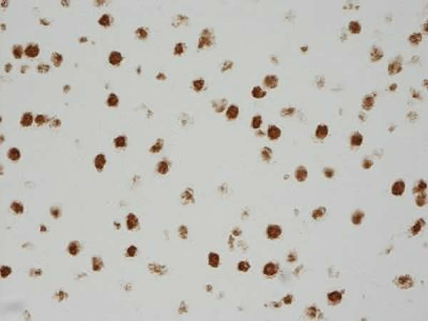 免疫组化显示温胆汤灌胃治疗14d后下丘脑及前额叶皮质中内源性脑肠肽表达增加