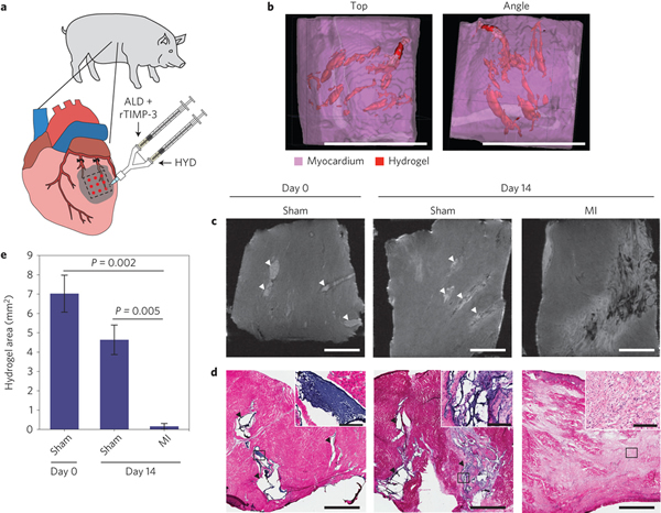 一种用于分子定位投递的生物响应材料或可治疗心脏病