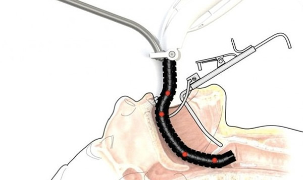 ҽ�����ѡ���е�����ߡ����벡�ߵĿ��У��������ԽӴ������١�