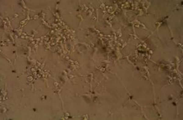 荧光倒置显微镜下,氨基化碳纳米管神经生长因子复合物诱导PC12 细胞分化明显,突起长且密集,交织成网状,生物活性强,细胞密度大(×200)