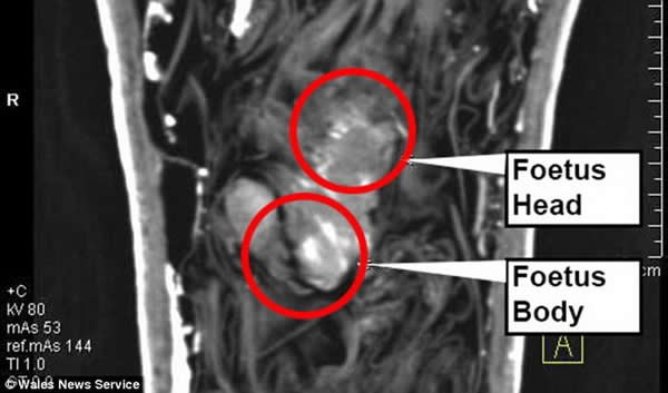 令科学家迷惑40年之久的木乃伊谜团揭晓