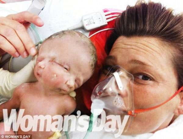 出生后与妈妈合影