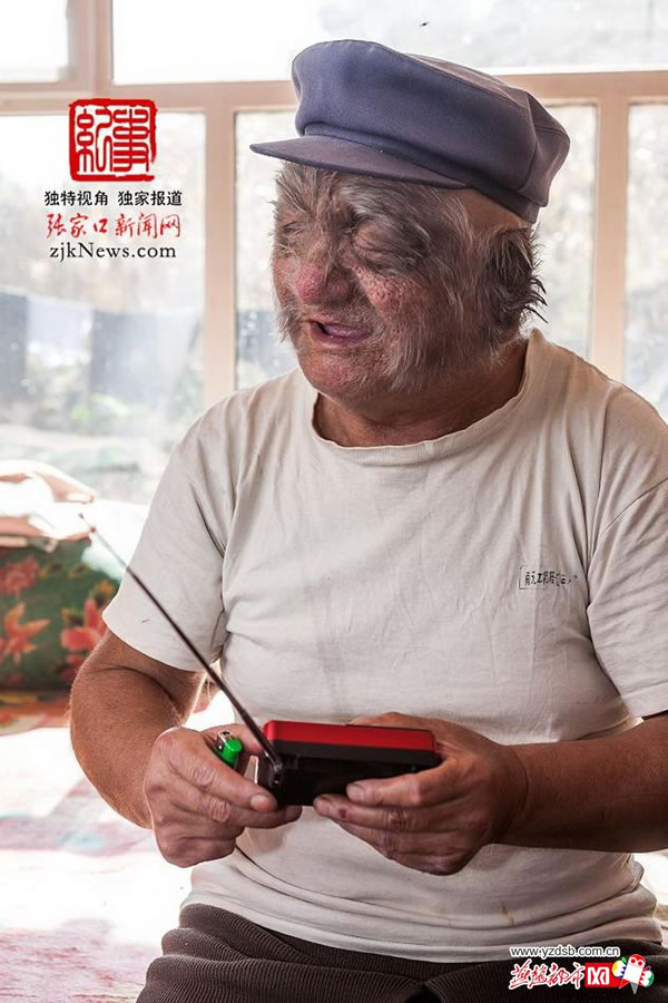 由于视力不好,张兴最喜欢是的外甥女给买的收音机