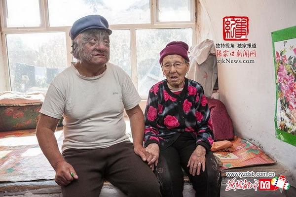 张兴最挂念的就是自己的老母亲