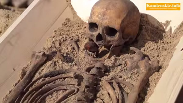 ����ѧ�ҷ����ź���ͷ������л�����һ��ʯͷ�����ɺ͡���Ѫ�������йء�