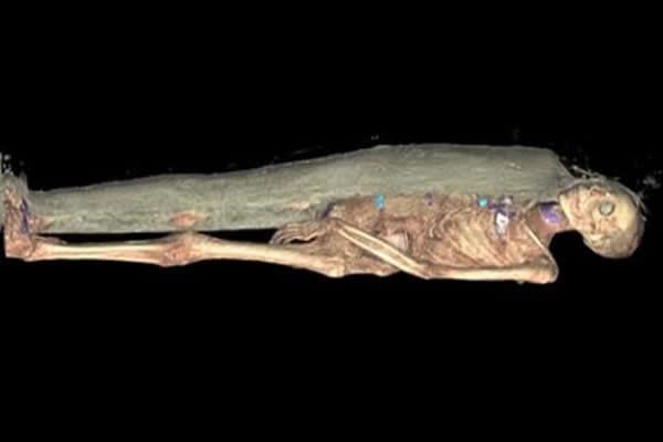 CT扫描后的木乃伊图像, 这具木乃伊制作时间大约在3000年前